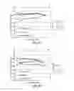 Fig. 29 - Methods and devices for knee joint replacement with anterior cruciate ligament substitution