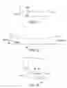Fig. 32 - Methods and devices for knee joint replacement with anterior cruciate ligament substitution