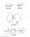 Fig. 37 - Methods and devices for knee joint replacement with anterior cruciate ligament substitution