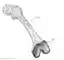 Fig. 01 - Extended patellofemoral