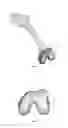 Fig. 02 - Extended patellofemoral