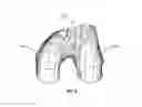 Fig. 04 - Extended patellofemoral