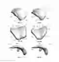 Fig. 06 - Extended patellofemoral