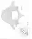 Fig. 02 - Methods for facet joint treatment