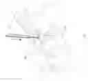Fig. 15 - Methods for facet joint treatment