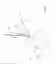 Fig. 16 - Methods for facet joint treatment