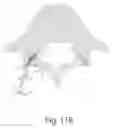 Fig. 20 - Methods for facet joint treatment