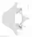 Fig. 21 - Methods for facet joint treatment