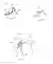 Fig. 37 - Methods for facet joint treatment