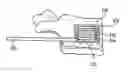 Fig. 01 - Expandable interbody fusion device