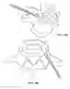 Fig. 10 - Method of in-situ formation of an intervertebral fusion device