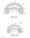 Fig. 19 - Method of in-situ formation of an intervertebral fusion device
