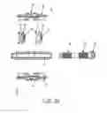 Fig. 17 - Spinous process fixation system and methods thereof