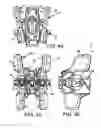 Fig. 26 - Spinous process fixation system and methods thereof