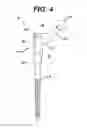Fig. 05 - Assembly tool for modular implants, kit and associated method