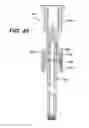 Fig. 43 - Assembly tool for modular implants, kit and associated method