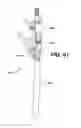 Fig. 59 - Assembly tool for modular implants, kit and associated method
