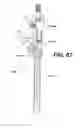 Fig. 65 - Assembly tool for modular implants, kit and associated method