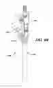 Fig. 67 - Assembly tool for modular implants, kit and associated method