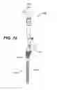 Fig. 68 - Assembly tool for modular implants, kit and associated method