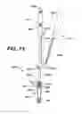 Fig. 71 - Assembly tool for modular implants, kit and associated method