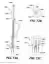 Fig. 72 - Assembly tool for modular implants, kit and associated method