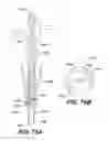 Fig. 76 - Assembly tool for modular implants, kit and associated method