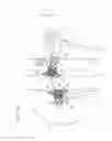 Fig. 07 - Prosthetic renal valve