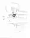 Fig. 11 - Prosthetic renal valve