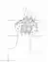 Fig. 13 - Prosthetic renal valve