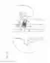Fig. 16 - Prosthetic renal valve