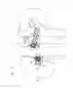 Fig. 18 - Prosthetic renal valve