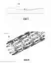 Fig. 05 - Vascular stents and related methods