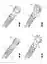 Fig. 06 - Vascular remodeling device