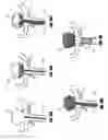 Fig. 16 - Vascular remodeling device