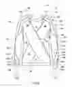 Fig. 04 - Orthopedic support garment