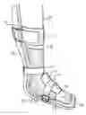 Fig. 01 - Leg Brace and Walking Aid with Retractable Wheels