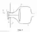 Fig. 02 - OSTOMY DEVICES