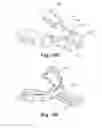 Fig. 16 - Methods and apparatuses for performing remote titration of mandibular protrusion