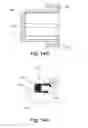 Fig. 17 - Methods and apparatuses for performing remote titration of mandibular protrusion