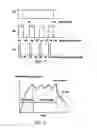 Fig. 07 - Method and system for endoscope-assisted non-invasive laser treatment of presbyopia
