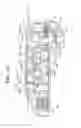Fig. 07 - Tympanic membrane pressure equalization tube delivery system
