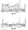Fig. 06 - Patient support guard structure