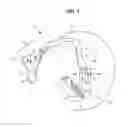 Fig. 02 - AIRWAY SUPPORT DEVICE