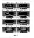 Fig. 02 - COMPOSITIONS AND METHODS FOR HAIR GROWTH