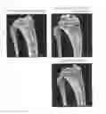 Fig. 02 - Therapeutic agent for osteoporosis
