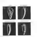 Fig. 03 - Therapeutic agent for osteoporosis