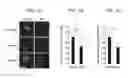 Fig. 02 - Methods of diagnosing and treating motor neuron diseases and other cellular stress-related diseases