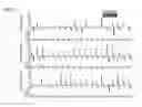 Fig. 04 - Methods of diagnosing and treating motor neuron diseases and other cellular stress-related diseases