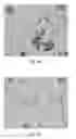 Fig. 04 - Pharmaceutical composition comprising 3-beta-hydroxy-5-alpha-pregnan-20-one with improved storage and solubility properties